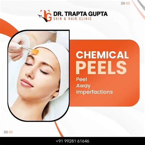 Unveiling The Wonders Of Chemical Peels A Guide To Glowing Skin By