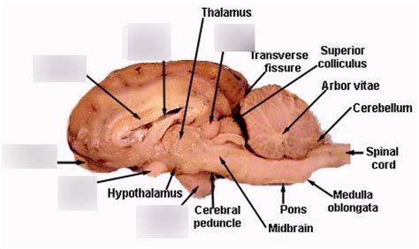 Diagram Of Sheep Brain Sagittal Quizlet