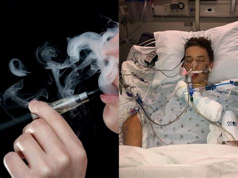 Health Canada Issues Second Vape Warning Amid Two Deaths U S Outbreak