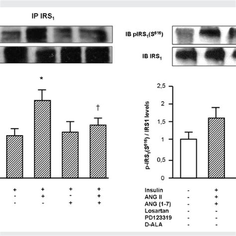 Effects Of Ang Ii And Ang 1 7 On The Insulin Pathway Induction Of