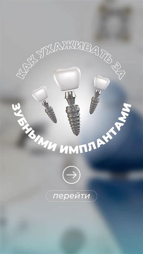 ИДЕИ СТОРИС ДЛЯ СТОМАТОЛОГА стоматология dentist stories dental SMM ...
