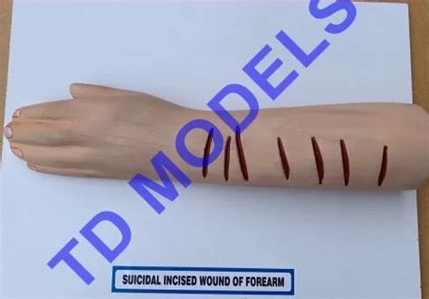 TD Model Skin Suicidal Incised Wound Of Forearm Models, For Medical Student at Rs 1500/piece in ...