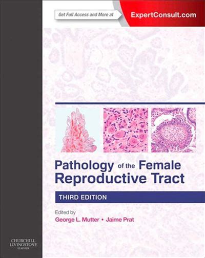 Pathology of the female reproductive tract relié George L Mutter