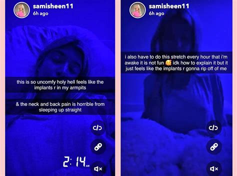 Sami Sheen Got The Boob Job And She S Sharing The Entire Journey On Social Media Perez Hilton