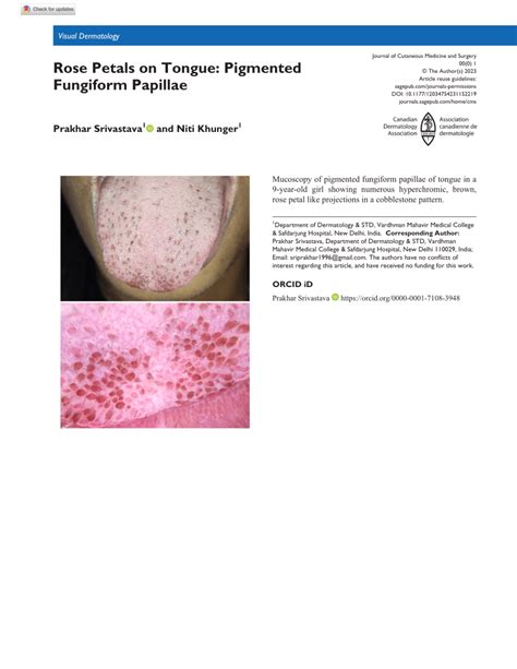 PDF Rose Petals On Tongue Pigmented Fungiform Papillae