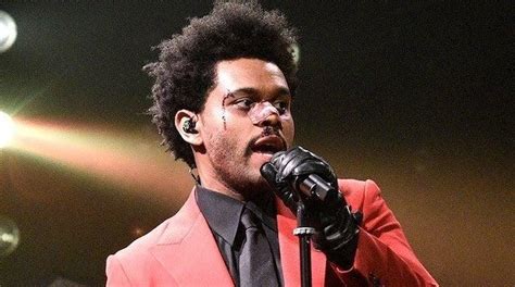 'SNL': The Weeknd's Bloody Face Confuses Fans