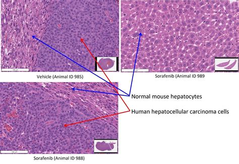 Orthotopic Liver Cancer Model In Athymic Nude Mice