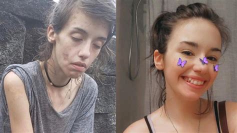 Una Joven Adicta A Las Drogas Quiere Que Veas Su Nueva Imagen Para