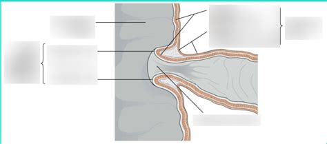 Ileocecal Junction Diagram | Quizlet