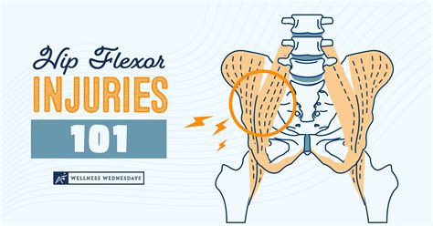 Hip Flexor Injuries 101 | Recovery and Prevention Tips | Airrosti