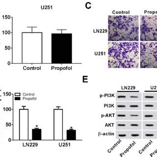 Propofol Inhibits The Migration Invasion And Pi K Akt Pathway