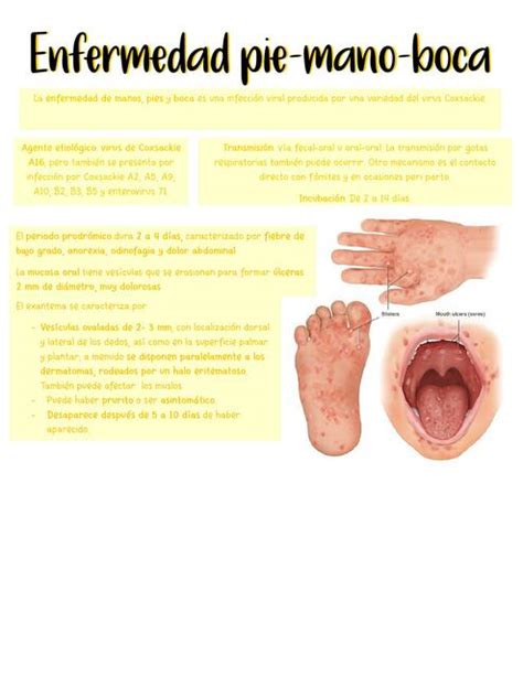 Enfermedad Pie Mano Boca Anahy Orduño Udocz