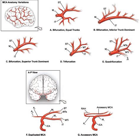 Mca Anatomy - Anatomical Charts & Posters