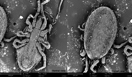 Ornithonyssus Bacoti Tropical Rat Mite Female Ventral And Dorsal