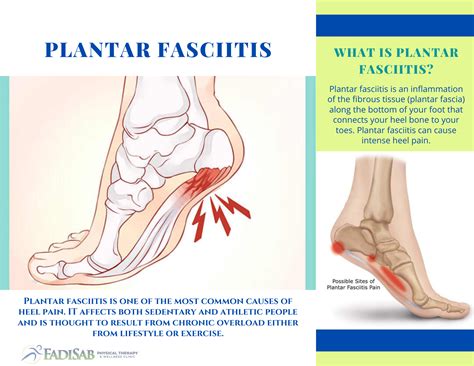 Back Pain and How To Treat It | FadiSab Clinic