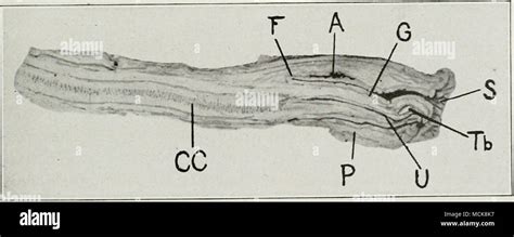 Fig Tuberculosis Of Glans And Prepuce G Glans P Prepuce