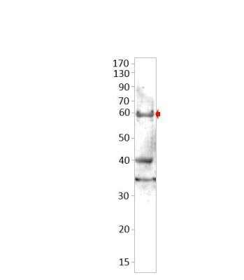 Slc A Antibody Nbp Novus Biologicals