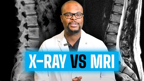 Mri Vs X Ray Whats The Difference Youtube