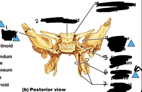 Sphenoid Bone Flashcards Quizlet