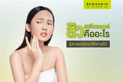 สิวขึ้นจมูกสาเหตุเกิดจากอะไร รวมวิธีรักษาสิวอย่างไรให้เห็นผล