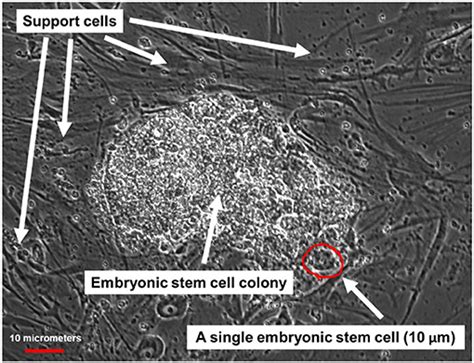 What Are Embryonic Stem Cells And How Can They Help Us Frontiers For