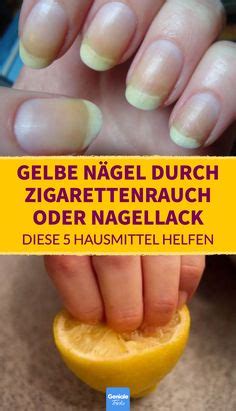 5 Tricks um gelbe Fingernägel wieder aufzuhellen Gelbe Nägel