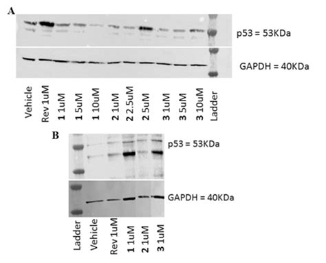 Western Blot Analysis To Determine P53 Expression After One Day Of Download Scientific Diagram