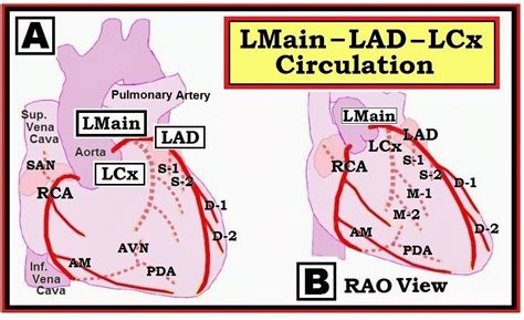 ECG Interpretation: ECG Interpretation Review #82 (Acute STEMI – RCA ...