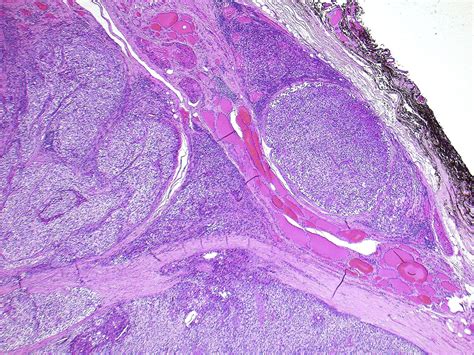 Histology Of Parathyroid Gland