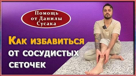 Как убрать сосудистые звездочки, избавиться от капиллярных сеточек на ...
