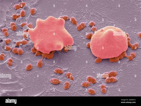 Streptococcus Pneumoniae Farbige Scanning Electron Micrograph Sem