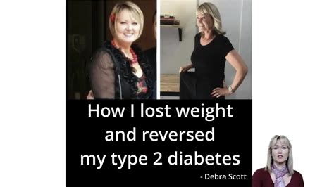 Debra Scott How I Lost Weight And Reversed My Type 2 Diabetes Youtube