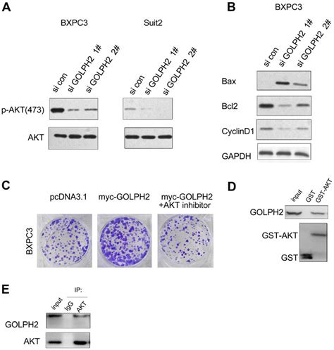 Golph Activates Akt Signaling In Bxpc And Suit Cells A Knocking