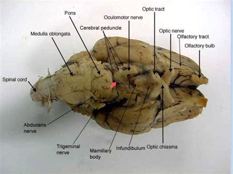 Pin By Iris Yeh On Final Anatomy Brain Anatomy Anatomy Anatomy Images