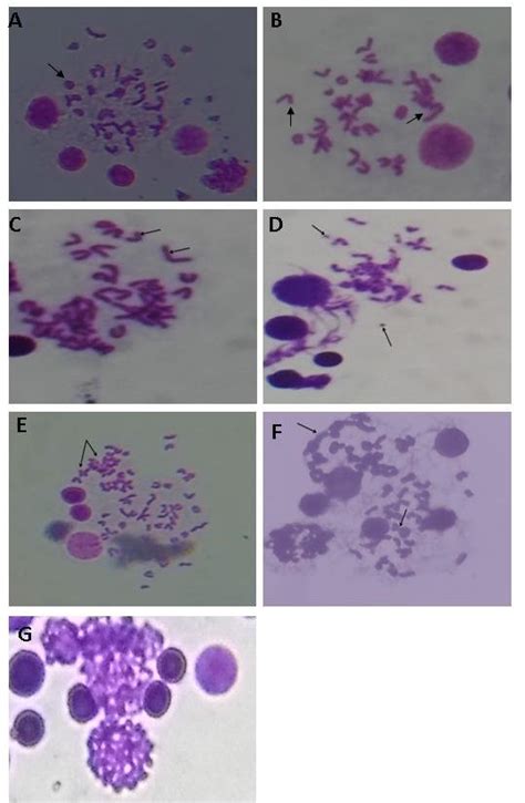 Metaphase Chromosome Of Mice Bone Marrow Cells After Iron Sulfate