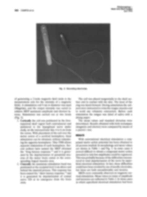 SOLUTION: Campos1995 nerve conduction velocity electromyography