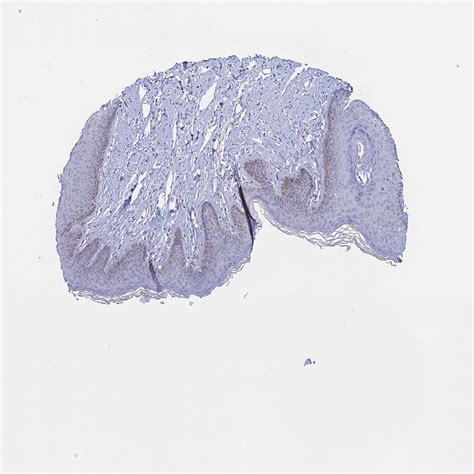 Tissue expression of MGST1 - Staining in skin - The Human Protein Atlas