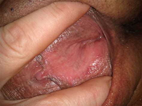 My Horny Happy Holes Pics Xhamster