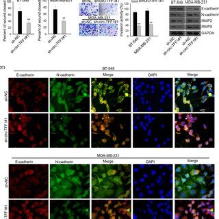 Silencing Of CircTFF1 Repressed Metastasis And EMT Process Of Breast