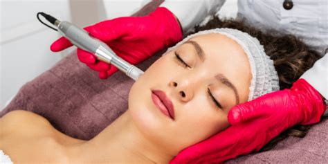 Microneedling Side Effects – yastrid store