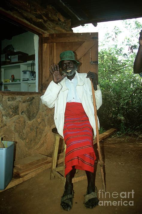 Eye Surgery Patient Photograph By Jason Kelvin Science Photo Library