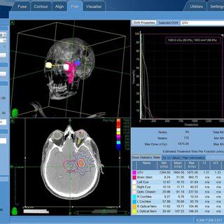 Serial T1-weighted post-contrast magnetic resonance imaging (MRI) scans ...