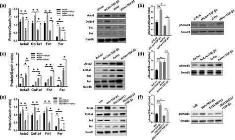 Erratum To Fer Exacerbates Renal Fibrosis And Can Be Targeted By MiR