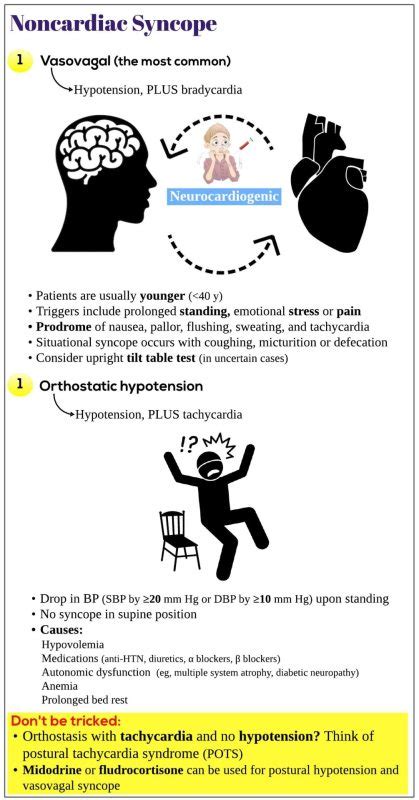 Noncardiac Syncope Medicine Keys For Mrcps