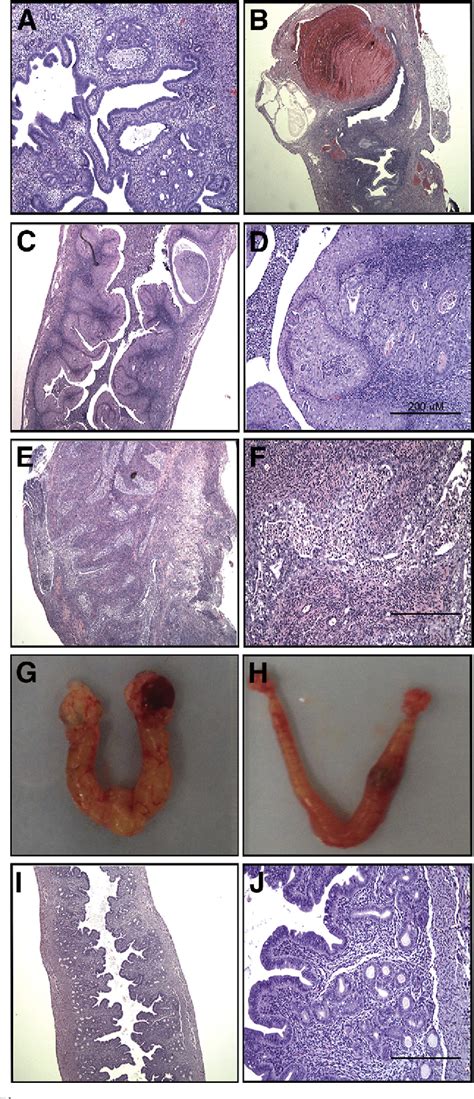 Figure 1 From Tumorigenesis And Neoplastic Progression Activated Mutant