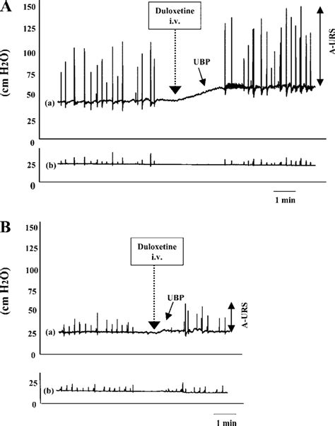 Representative Traces Of Urethral And Abdominal Pressure Changes Before