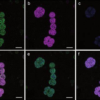 Laser Confocal Scanning Micrographs Of Far Red Light Grown