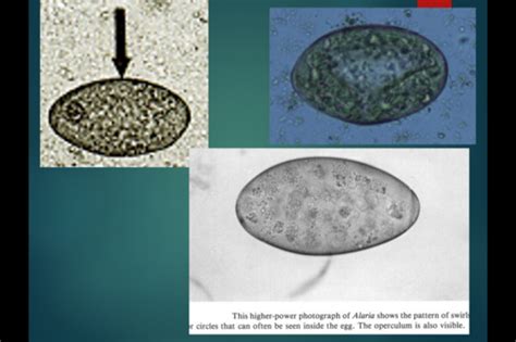 Parasites Lab 4 Flashcards Quizlet