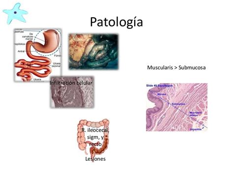 Amebiasis Intestinal