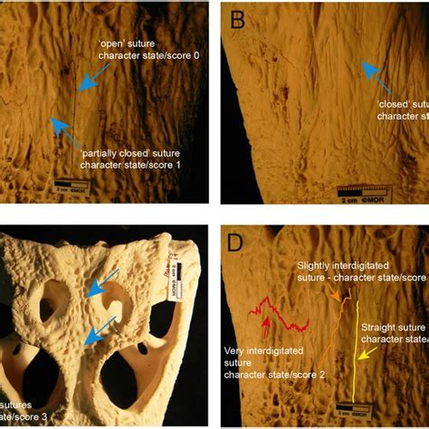 Transverse sections through the frontoparietal suture, the internasal ...